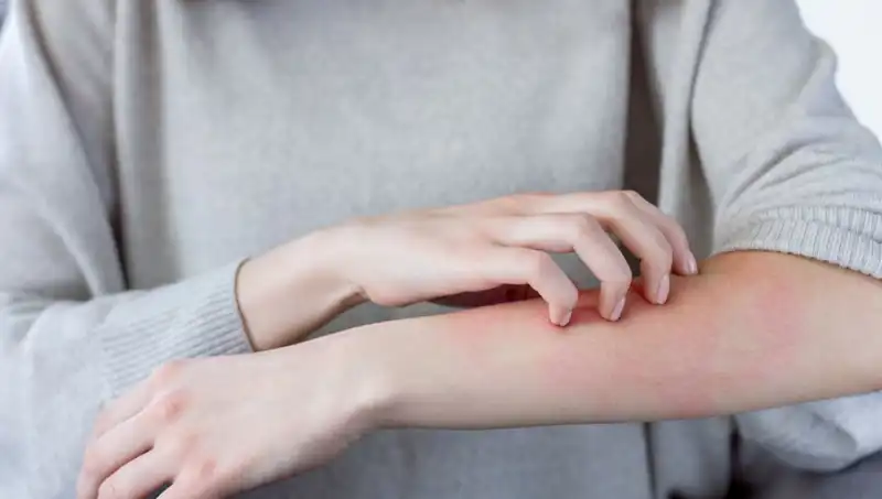 Cilt Kanserinin İki Gözden Kaçan Belirtisi: Dermatologdan Önemli Uyarılar
