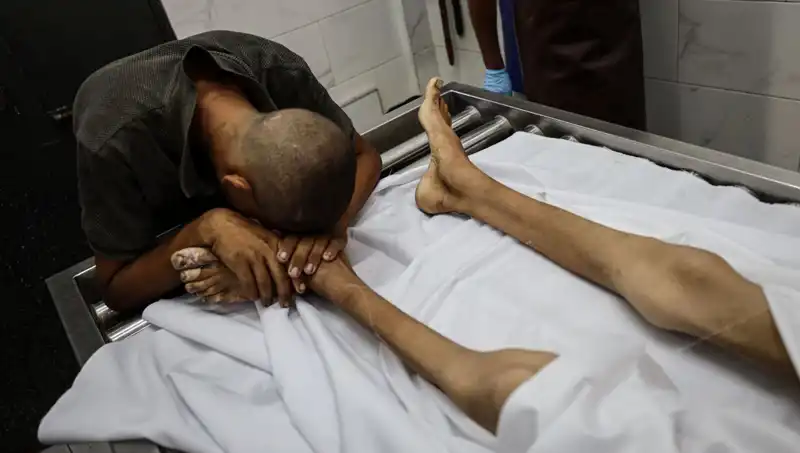 Gazze'deki Çocuklar Açlıkla Savaşırken Bir Can Daha Kaybedildi